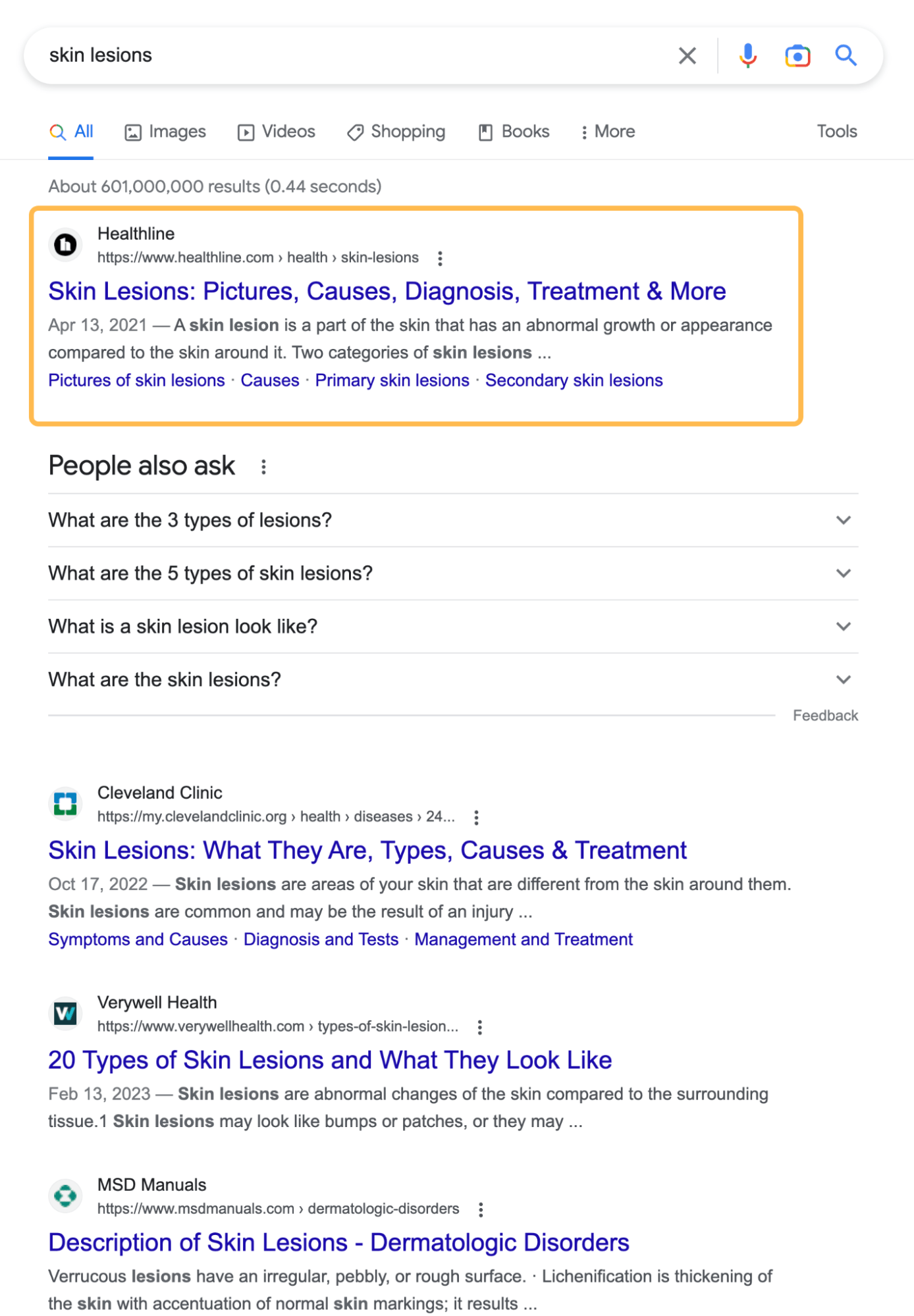 Healthline's Content Anatomy: 5 SEO Insights to Learn From | SERP for skin lesions