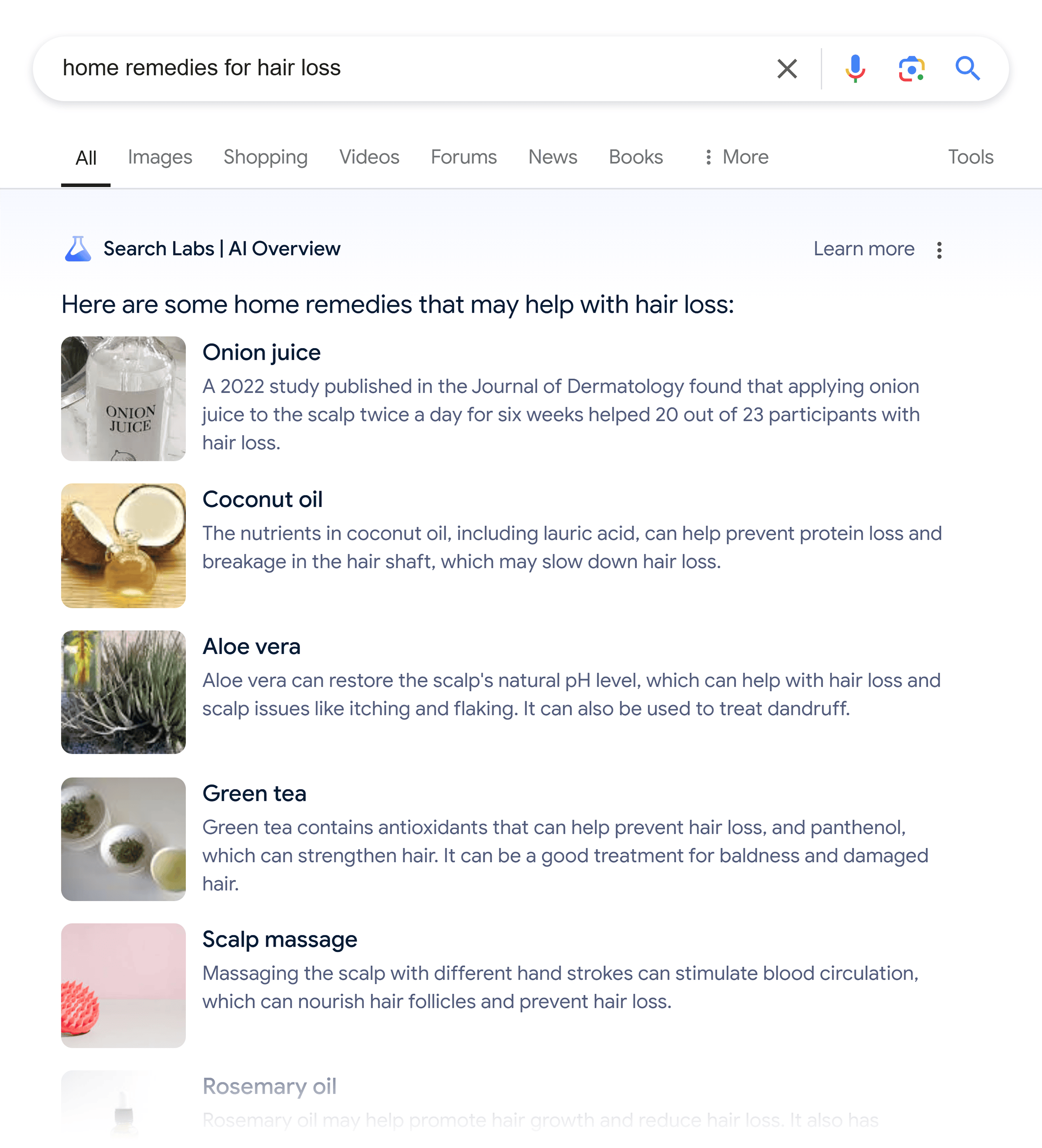 Google SERP – Home remedies for hair loss – AI Overview Google SERP – Home remedies for hair loss – AI Overview